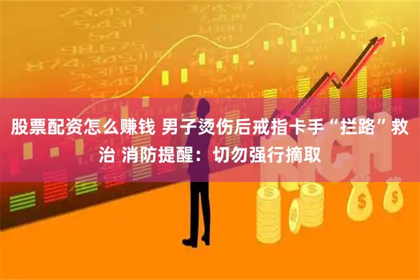 股票配资怎么赚钱 男子烫伤后戒指卡手“拦路”救治 消防提醒：切勿强行摘取